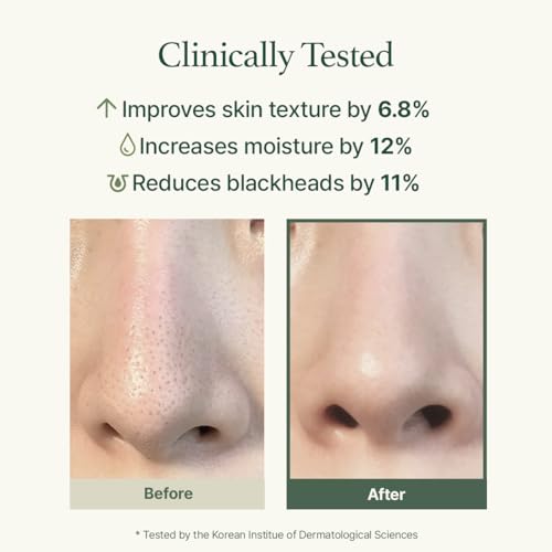 Korean Rice Mochi Face Cleanser - Face Wash, Gentle Scrub All in One for Deep Cleansing, Moisturizing, Pore Minimizing, Acne-Prone Skin, Removing Blackhead with Rice Water & Green Tea