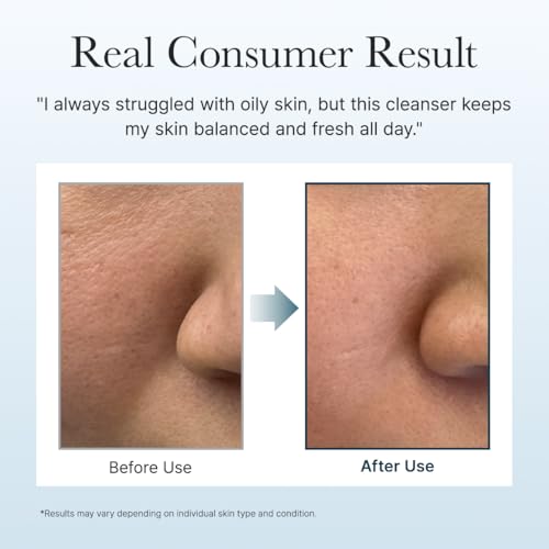 Korean Rice Mochi Face Cleanser - Face Wash, Gentle Scrub All in One for Deep Cleansing, Moisturizing, Pore Minimizing, Acne-Prone Skin, Removing Blackhead with Rice Water & Green Tea