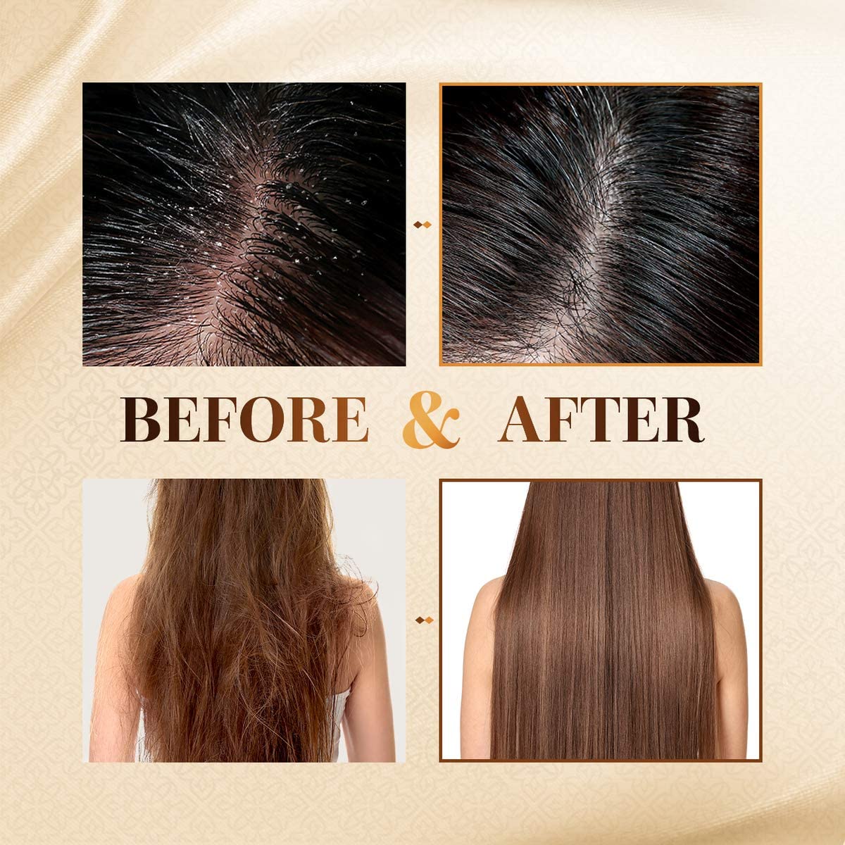 CP-1 Ginger Purifying Conditioner, Repair damaged hair, Scalp care, Recovery Strengthen care, 16.9 fl oz