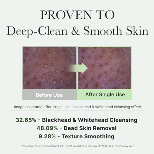 Korean Rice Mochi Face Cleanser - Face Wash, Gentle Scrub All in One for Deep Cleansing, Moisturizing, Pore Minimizing, Acne-Prone Skin, Removing Blackhead with Rice Water &amp; Green Tea